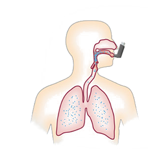 Pomoc inhalacyjna, opis bez AeroChamber